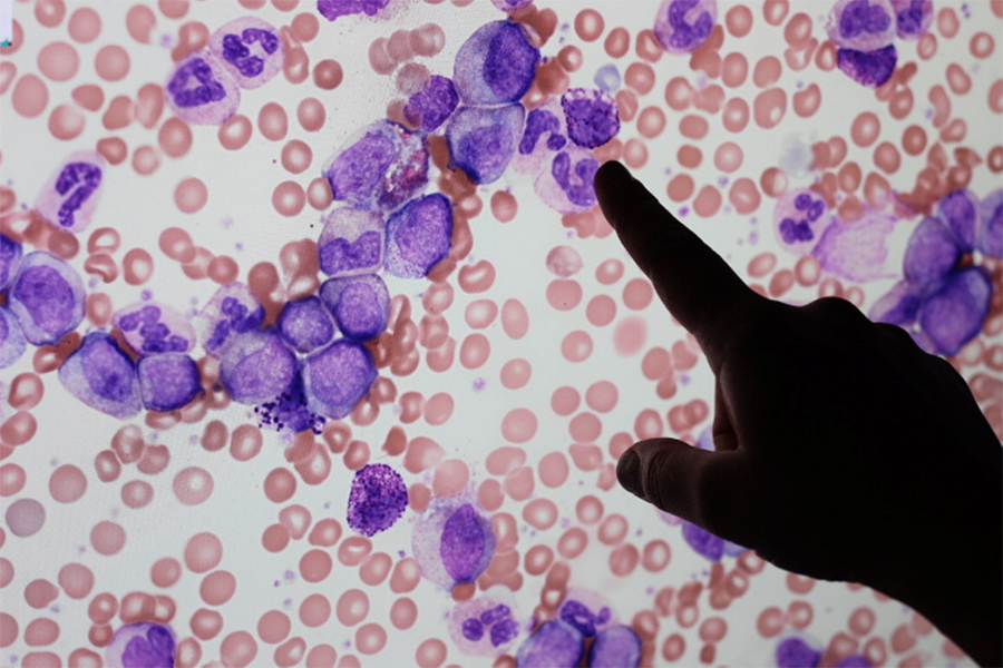 basophil